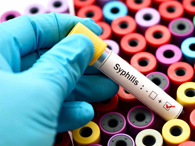 Як не заразитися сифілісом і що робити, якщо це сталося