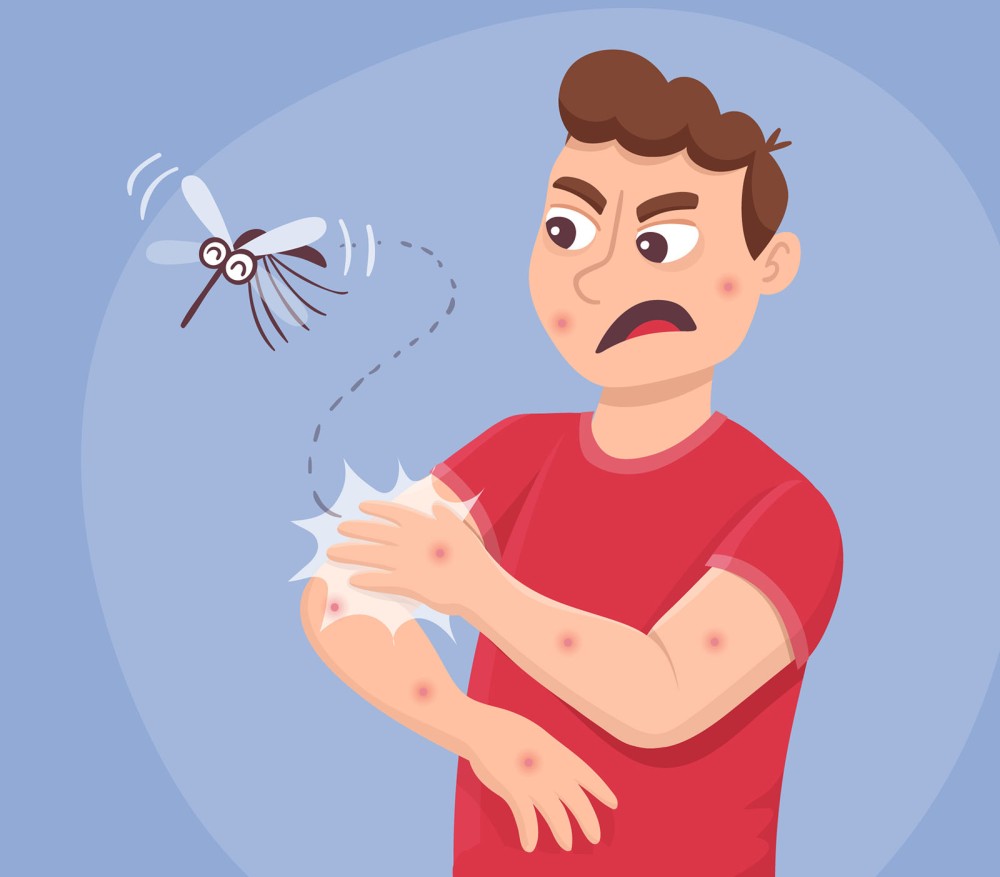 Що робити в разі укусу комара