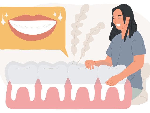 Керамічні вініри: як отримати ідеальну голлівудську посмішку