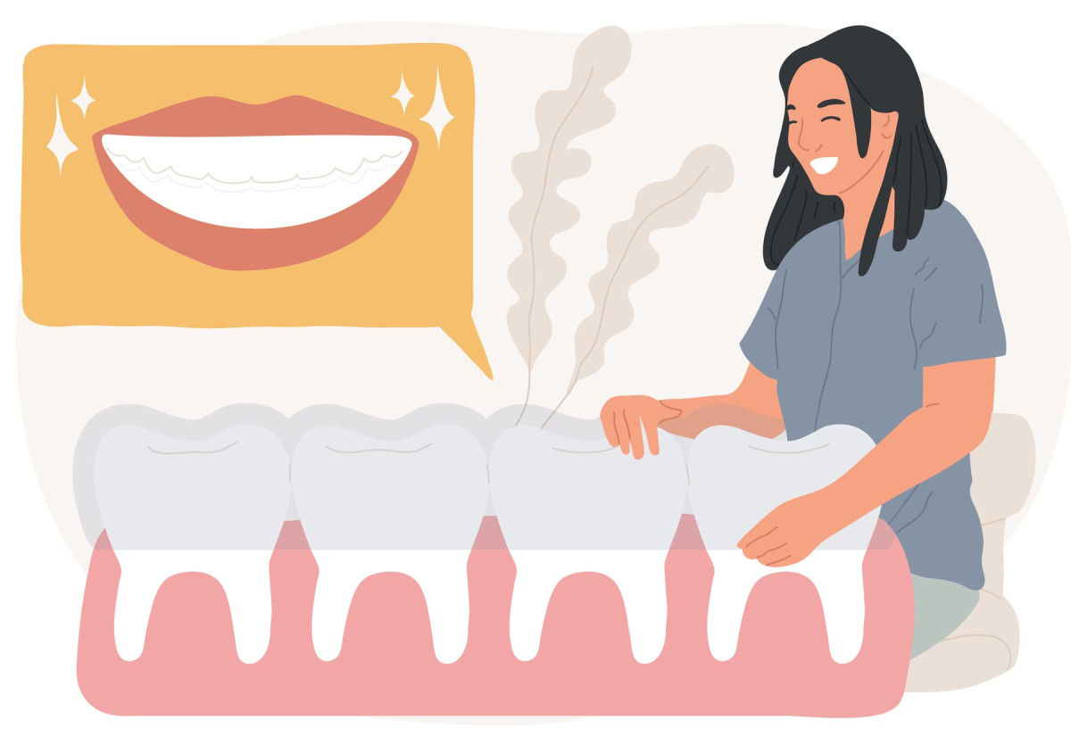 Керамічні вініри: як отримати ідеальну голлівудську посмішку