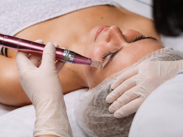 Мікроголковий RF-ліфтинг: відповіді на поширені запитання пацієнтів