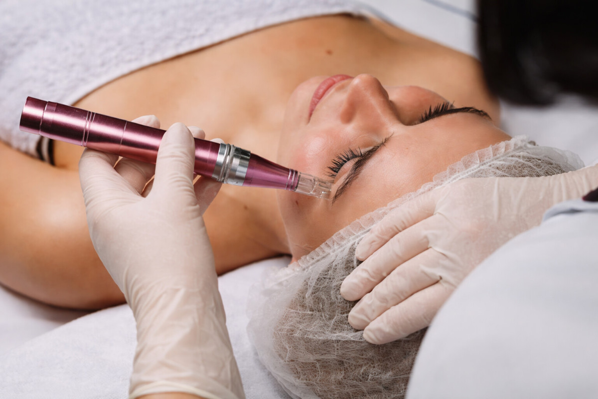 Чому РФ-ліфтинг називають процедурою розумного омолодження?