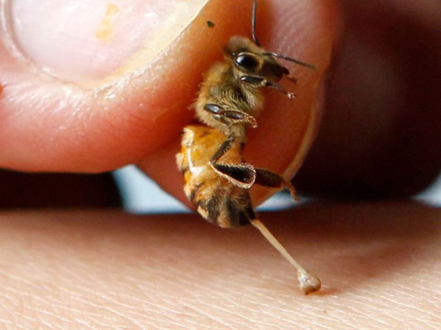 Перша допомога при укусі бджоли, оси, шершня чи джмеля